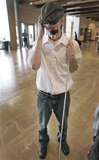 
 **EDS NOTE GRAPHIC CONTENT** Dallas Wiens, 25, speaks on a cell phone in Fort Worth, Texas, Wednesday, Oct. 13, 2010. Weins was critically burned in a 2008 high-voltage power line accident and is waiting for a face transplant. (AP Photo/LM Otero)
 