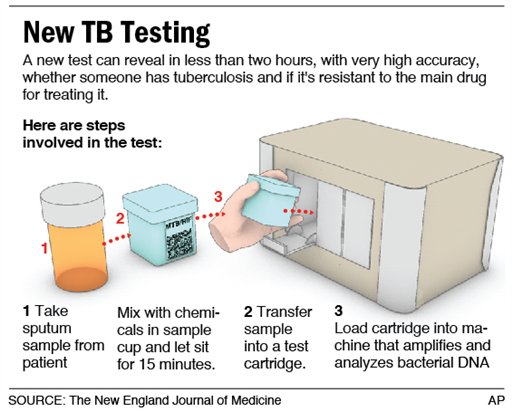 New test. Sputum Test. Sputum Test procedure. Sputum Tests tuberculosis.