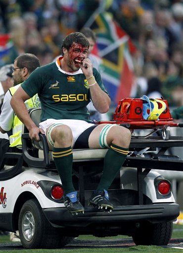 
 FILE - In this Aug. 21, 2010, file photo, South Africa's Flip van der Merwe is driven away by a paramedic after suffering an injury during a Tri Nations rugby match against New Zealand at FNB stadium in Johannesburg, South Africa. Though injury rates in rugby are as high or higher than those in American football, there has never been a push to bring helmets and heavy padding into the game. (AP Photo/Themba Hadebe, File)
 