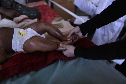 
 A Yemeni nurse checks on a child suffering from chronic malnutrition in a hospital in Sanaa, Yemen, Wednesday, Nov. 10, 2010. More than 50 percent of Yemen's children are malnourished, rivalling war zones like Sudan's Darfur and parts of sub-Saharan Africa. That's just one of the worrying statistics in Yemen. Nearly half the population lives below the poverty line of $2 a day and doesn't have access to proper sanitation. Less than a tenth of the roads are paved. Water is running out. Tens of thousands have been displaced from their homes by conflict, flooding into cities. The government is riddled with corruption, has little control outside the capital, and its main source of income _ oil _ could run dry in a decade. (AP Photo/Muhammed Muheisen)
 