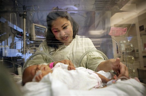 
 Haydee Ibarra looks at her 14-week-old daughter, Melinda Star Guido, at the Los Angeles County-USC Medical Center in Los Angeles, Wednesday, Dec. 14, 2011. At birth, Melinda Star Guido tipped the scales at only 9 1/2 ounces, a tad less than the weight of two iPhone 4S. Most babies her size don�t survive, but doctors are preparing to send her home as soon as the end of the month. Melinda is believed to be the second smallest baby to survive in the United States and the third smallest in the world. (AP Photo/Jae C. Hong)
 