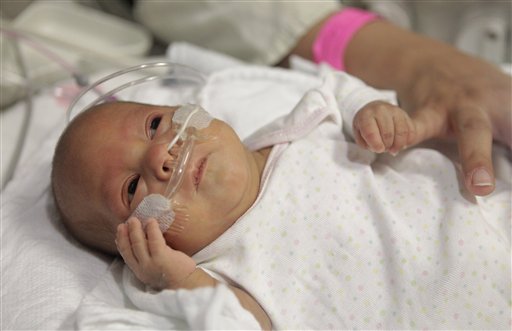 
 14-week-old Melinda Star Guido holds her mother's little finger while lying in an incubator at the Los Angeles County-USC Medical Center in Los Angeles, Wednesday, Dec. 14, 2011. At birth, Melinda Star Guido tipped the scales at only 9 1/2 ounces, a tad less than the weight of two iPhone 4S. Most babies her size don�t survive, but doctors are preparing to send her home as soon as the end of the month. Melinda is believed to be the second smallest baby to survive in the United States and the third smallest in the world. (AP Photo/Jae C. Hong)
 