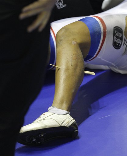
 A splinter is seen through the leg of Malaysia's Azizulhasni Awang after a crash in the Men's Keirin Final during the Track Cycling World Cup at the National Cycling Centre, Manchester, England, Saturday Feb. 19, 2011. Awang finished third in the race. (AP Photo/Jon Super)
 